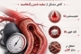 آیا فشار خون بالا فقط به مصرف نمک مربوط می شود؟! 