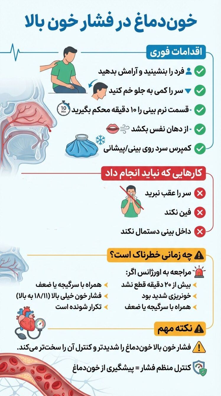 خون دماغ در فشار خون بالا 